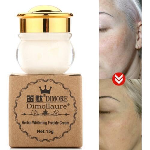 Dimollaure Strong Effect Whitening Freckle Face Cream Scar Removal Melasma Speckle Acne Spots Pigment Melanin Dark Spots Dimore