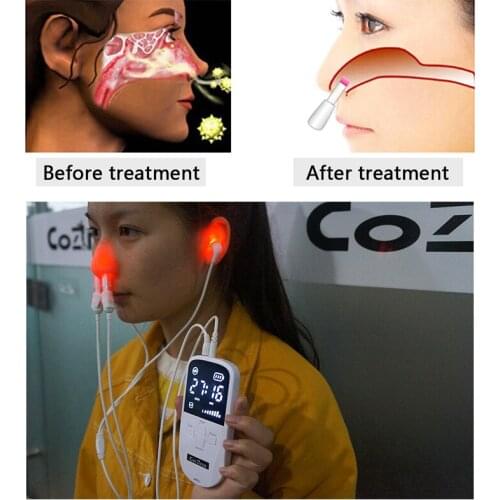 Nose Rhinitis Allergy Nose Clip SnoreStop Sleep Snoring Strap Device Sinusitis Cure Reliever Laser Therapy Treatment