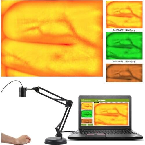 Advanced Adjustable Adult Children Vein Viewer Display Infrared Lights USB Camera Imaging IV Medical Vein Finder