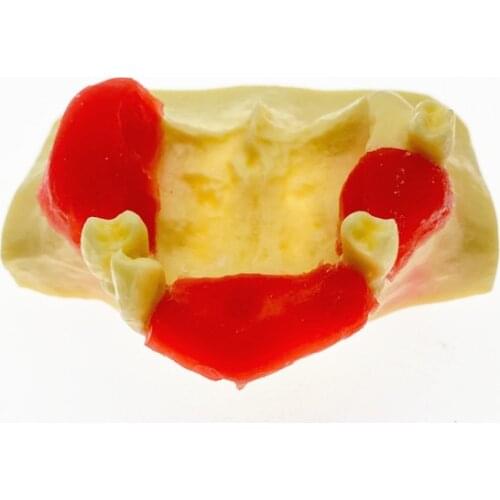 NEW Dental Sinus Lift Practice Teeth Model Typodont Study Model 2013 01