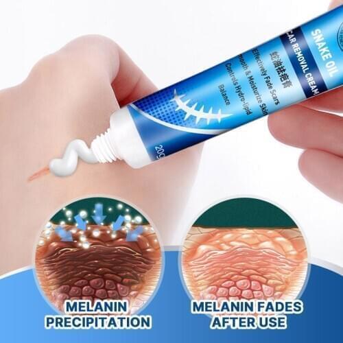 Good Effective Snake Oil Scar Removal Cream For Old Scar Caesarean Scars Surgical Scars Burn Bcars Body Care Herbs Cream