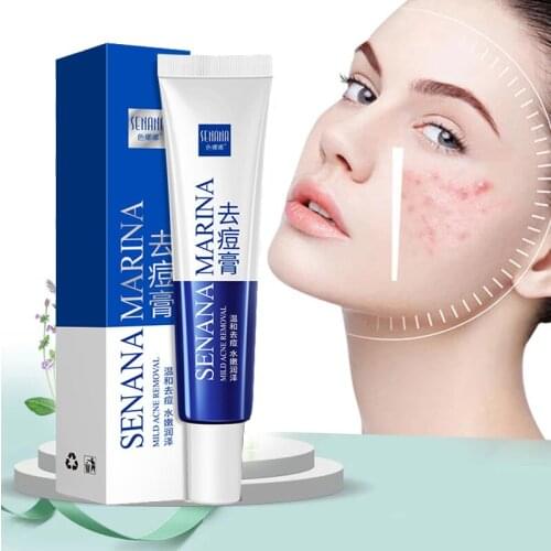 Acne Removal Cream Acne Treatment Fade Acne Spots Oil Control Shrink Pores Whitening Moisturizing Acne Cream Skin Care