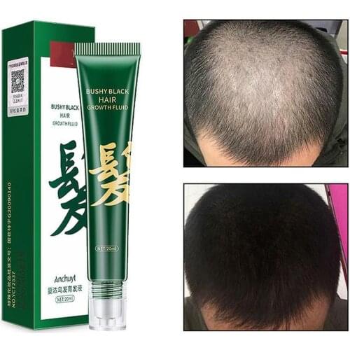 Головка массажный инструмент Sevich China At AliExpress