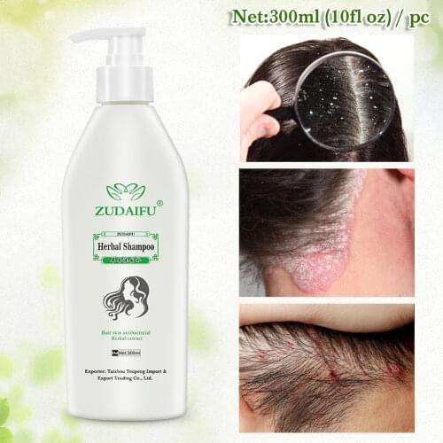 1Pcs Zudaifu Skin Psoriasis Cream Herbal Seborrheic Dermatitis Shampoo 120ml