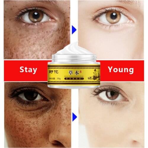 30g New Creative Retinol Moisturizer Cream Wrinkles Day and Night for Face Eye Area with Retinol Vitamin E Reduces Appearance