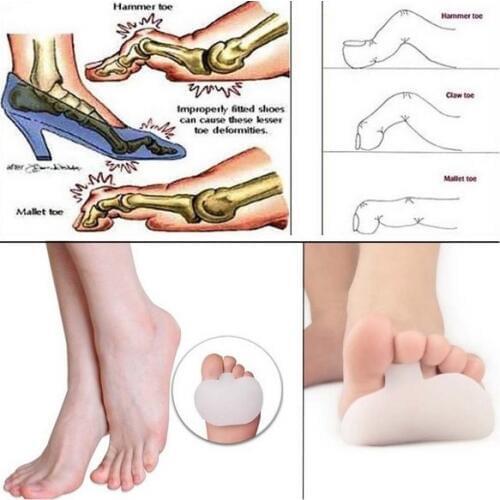 1Pair Claw Hammer Gel Metatarsal Pad Sore Ball Foot Feet Pain Cushion Forefoot Pads Insoles Support Cushion Foot Gel