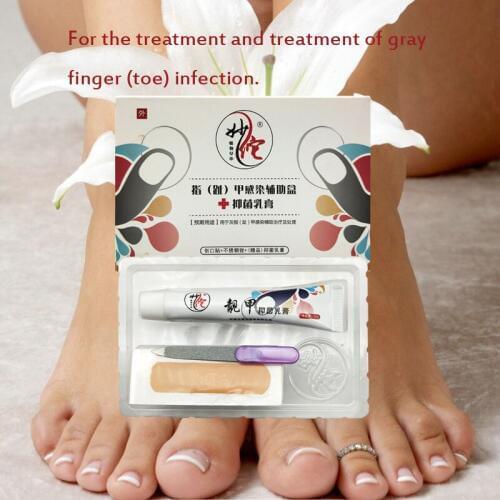 Nail Fungus Treatment Ointment Treatment Toe Nail Onychomycosis Paronychia Anti Fungal Nail Infection Wholesale
