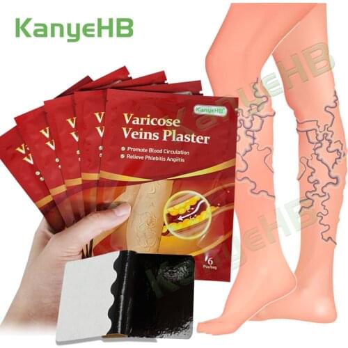 12pcs/2bags Chinese Varicose Veins Patch Vasculitis Phlebitis Leg Medical Plaster Treatment Varicosity Angiitis Stickers A593