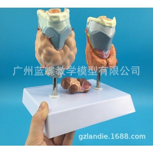 Human thyroid pathology Hyperthyroidism anatomical model Thyroid tumor medical model