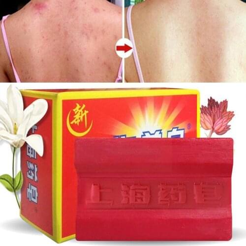 130g Medicine Soap Hand Soaps Acne Bath Removing Mites Deep Cleanse Odor Remove Brand Soap Soap Shanghai China Whole Sebum H9H3