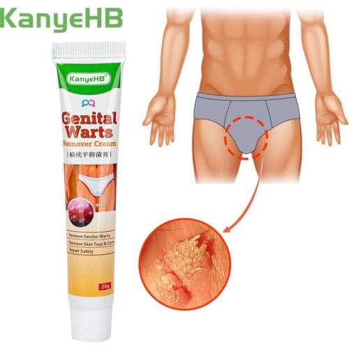 Genital Warts Remover Ointment Private Part Penis Vulva Wart Remover Cream Treatment Condyloma Acuminatum Herbal Plaster G005