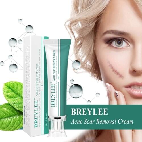 Removal Scar Cream Face Pimples Scar Stretch Marks Removal Acne Treatment Removal Scar Cream Pigmentation Corrector