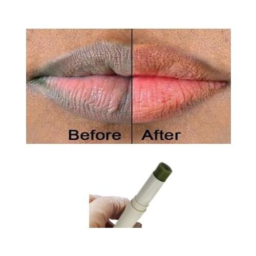 1pcs Lips Pink Fresh Lightening Bleaching Cream Treatment Remove Dark Smoke Lips lip oil