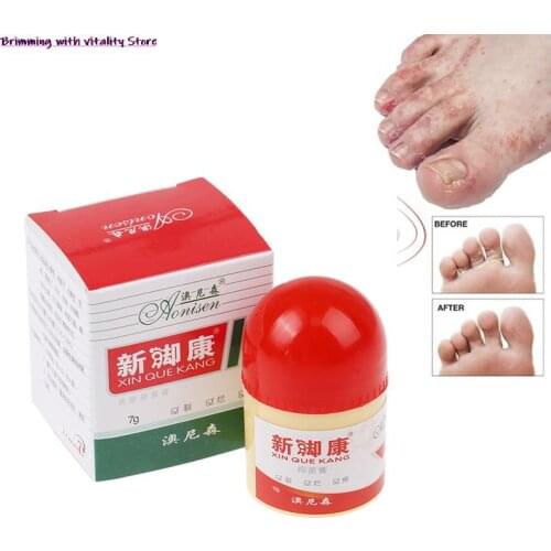 Foot Cream Antibacterial Foot Cream Foot Rot Peeling Itching Blisters To Remove
