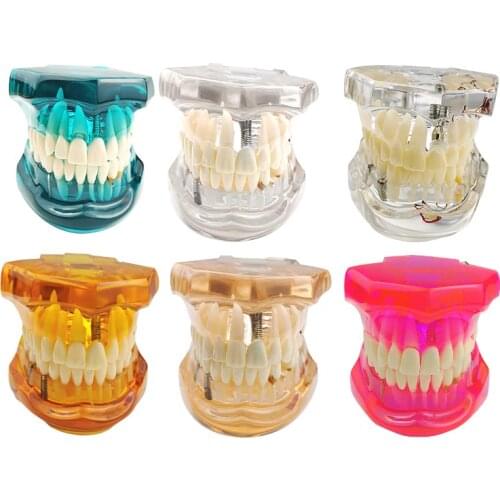 Dental Study Tooth Model Plant Restoration Model Pathological Teeth Model Fit for Dental Teaching Model