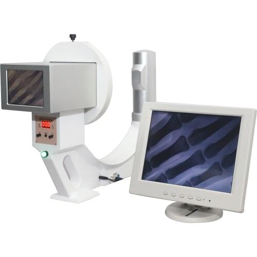Portable Low-Lntensity Medical Digital Mini C-Arm X-Ray