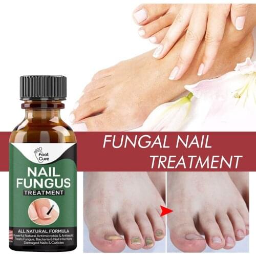 1pcs Fungal Nail Repair Essence Serum Care Treatment Foot Nail Fungus Removal Oil Foot Care Removal Repair Essence Nail
