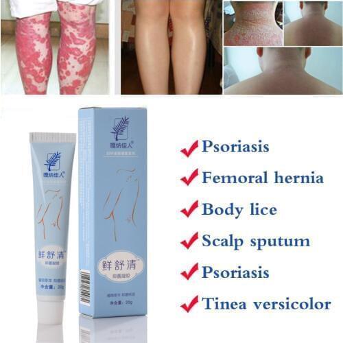 Professional Cure Psoriasis Ointment Original Works Perfect For All Of Skin Problems Patch Chinese Medicine