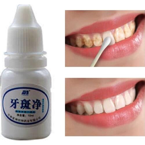 10ml Teeth Whitening Water Oral Hygiene Cleaning Teeth Care Tooth Cleaning Whitening Water Clareamento Dental Odontologia 1PC