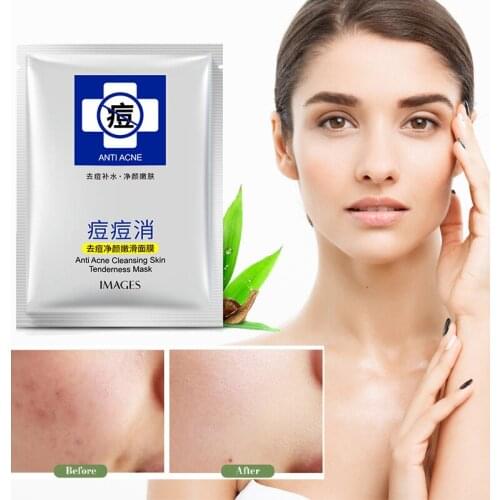 3 PCS Anti Acne Cleansing Skin Mask Remove Blackheads Moisturizer Oil Control Brighten Essence Aloe Shrink Pores Firm Skin Care