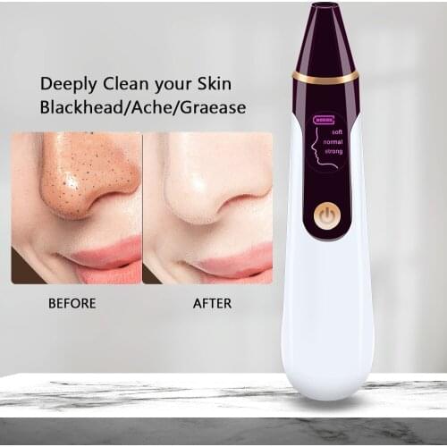 Visualization Blackhead Remove Machine Vacuum Blackhead Remove Facial Deep Nose Cleaner Pore Acne Facial Cleansing Skin