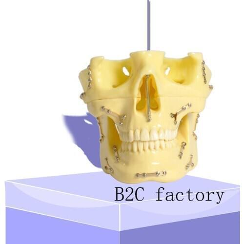 Dental model 2016 Anchor Implant Screw Practice Model