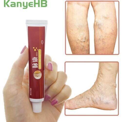 1pcs Varicose Veins Treatment Cream Vasculitis Phlebitis Spider Leg Pain Relief Ointment Original Herbal Medical Plaster S034