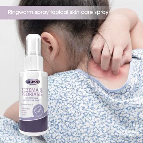Non-Steroidal 100% Natural Extract Relief Eczema Psoriasis Spray Strong Effective Treatment Psoriasis Dermatitis Eczematoid