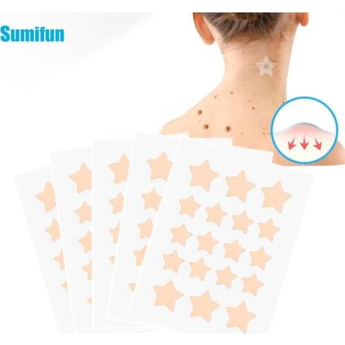 54pcs Skin Tag Remover Warts Acne Remover Patch Wart Treatment Cream Herbal Extract Foot Corn Plaster Acne Warts Plaster