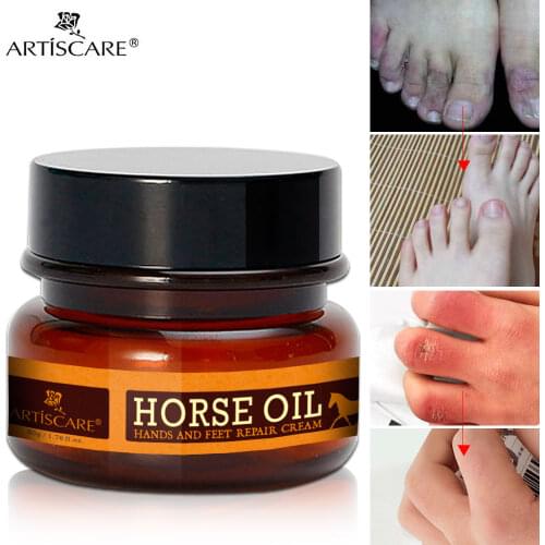 ARTISCARE Horse Oil Hand Cream and Feet Cream Repair Anti-Aging Winter Anti-crack Whitening Hand lotion Nourishing Peach Lotion