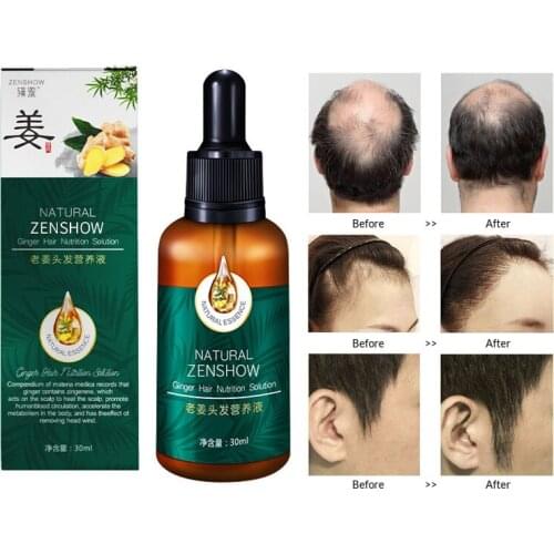 30ml Hair Care Hair Growth Serum Hair Treatment Ginger Hair Oil For Fast Hair Growth Magical Hair Treatment Hair Root