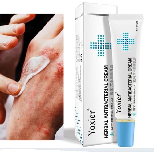 20g Herbal Antibacterial Cream Skin Dermatitis Treatment Anti-itch Relief Skin Rash Irritation Allergies Urticaria Skin Care
