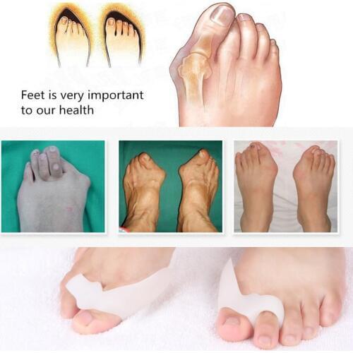 1Pair=2pcs Feet Care Hallux Valgus Tool Bunions Care Toe Corrector Toes Thumb Braces & Supports Gel Insoles Toe Separators