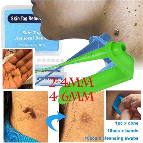 Blue Tag Tattoo Remaval Mole Removal Dark Spot Remover Medical Skin Tag Kill Skin Mole Wart Beauty Salon Wart Face Care Tool