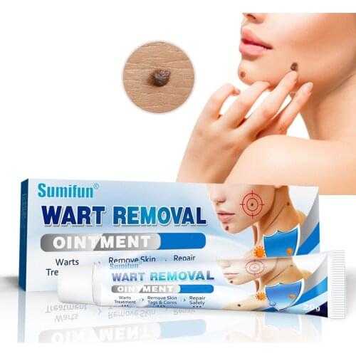 20g Wart Removal Skin Tag Treatment Cream Mole Corn Remover Natural For Genital/Flat Warts Herpes Acne Removing Plaster
