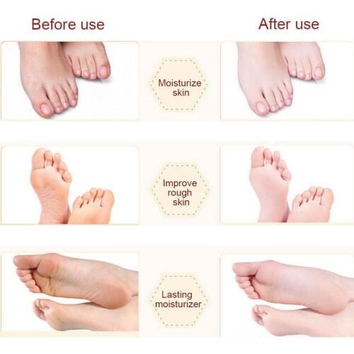 Hot Foot Peel Mask Exfoliating Callus Dead Skin Remover Smooth Feet Care for Men Women sy998