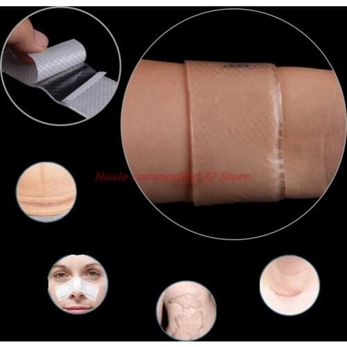 Skin Care Repair Removal Patch Reusable Acne Gel Scar Therapy Silicone Patch Remove