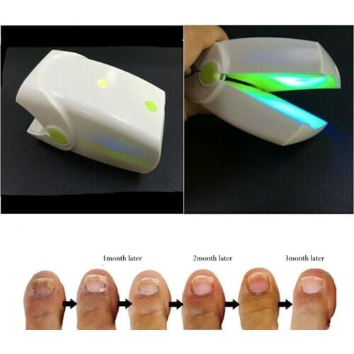 Cold Laser Nail Fungus Therapy Device Professional Stop Toe Finger Nail Fungal Infection Light Therapy Treatment Machine