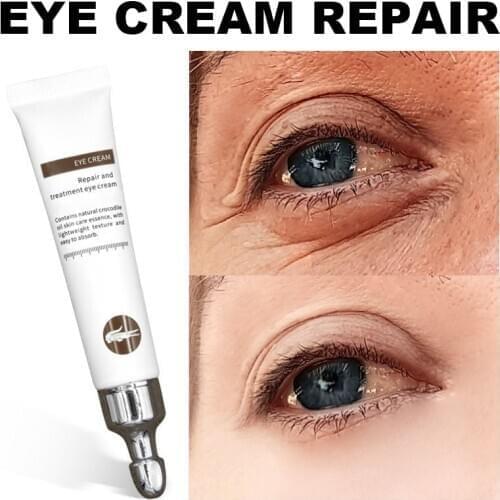Magic Anti-age Eye Cream Peptide Collagen Serum Reduce Dark Circles Puffiness Under Eye Bags Hydrate Wrinkles Remove Eye Creams
