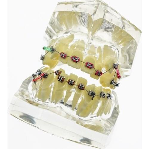 Dental Transparent Orthodontics Treatment Model Teeth Study/Teach Model #3005 02