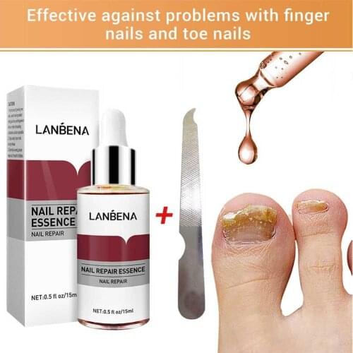 Nail Fungus Repair, Maximum , Nail Repair, Restores Healthy Appearance Of Discolored & Damaged Nails