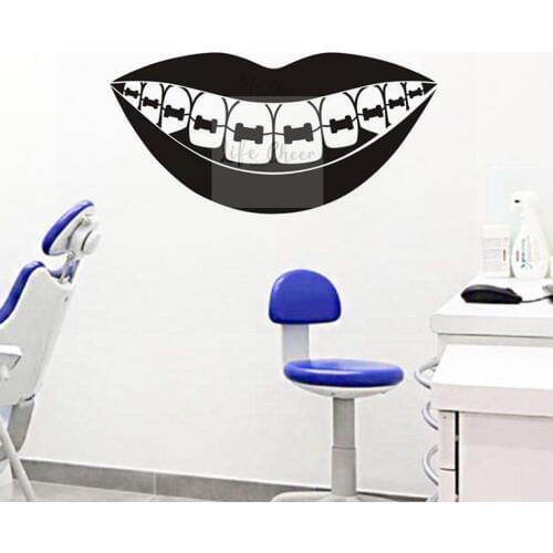 Dental Barces Wall Art Decal Teeth Care Clinic Decoration Dentist Service Wall Vinyl Sticker Mouth Teeth Removable Poster AC008