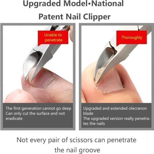 Professional Toe Nail Clippers Nail Groove Special Nail Scissors Oblique Mouth Olecranon Toenails Scissors Pedicure Nail Clipper