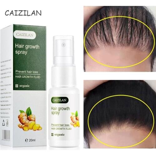 VOVA Hair Oils