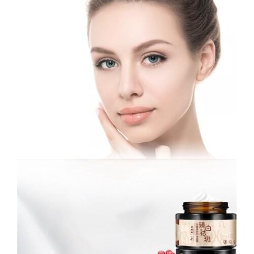 30g Powerful Whitening Freckle Cream Remove Melasma Acne Spots Pigment Melanin Dark Spots Face Lift Firming Face Care Cream skin