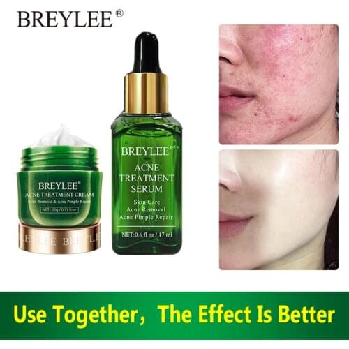 BREYLEE Acne Treatment Face Cream Set Removal Acne Marks Pimple Shrink Pore Oil Control Essence Smooth Whiten Facial Skin Care