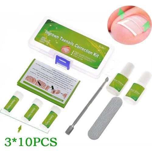 30PCS Set Correction Nail Incarceration Correction Patch Toe Nail Pedicure Tool Foot Care Fixed Orthosis Protection Set 3 Style