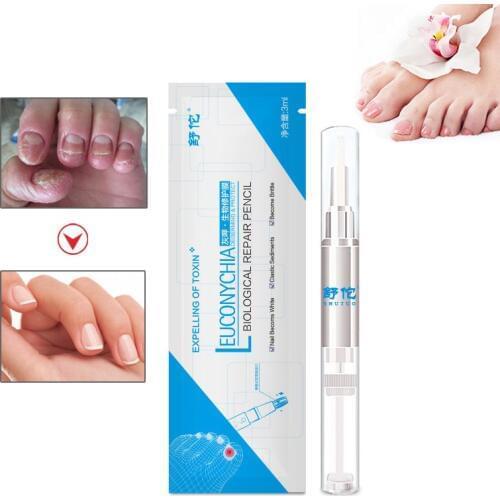 Fungal Nail Treatment Pen Anti Fungal Nail Infection Herbal Onychomycosis Nails Repair Essence Toe Feet Care Solution
