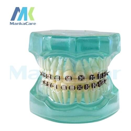 Manka Care - 28 pcs Tooth, half metal&half ceramic bracket Oral Model Teeth Tooth Model