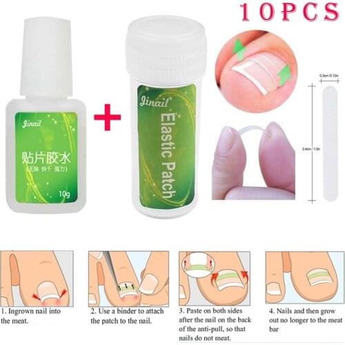10PCS/Bottle Ingrown Toenail Correction Tool Set Ingrown Toe Nail Pedicure Elastic Patch Straightening Clip Brace with Glue